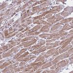 PITPNM1 Antibody in Immunohistochemistry (Paraffin) (IHC (P))