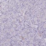 PITPNM1 Antibody in Immunohistochemistry (Paraffin) (IHC (P))