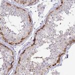 C19orf81 Antibody in Immunohistochemistry (IHC)