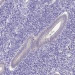 C19orf81 Antibody in Immunohistochemistry (IHC)