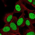 ZNF554 Antibody in Immunocytochemistry (ICC/IF)