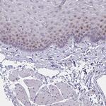 ZNF554 Antibody in Immunohistochemistry (Paraffin) (IHC (P))