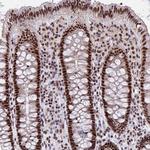 SYNE4 Antibody in Immunohistochemistry (Paraffin) (IHC (P))