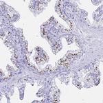 ZNF432 Antibody in Immunohistochemistry (Paraffin) (IHC (P))