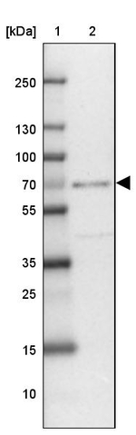 ZNF432 Antibody in Western Blot (WB)