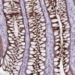 PRSS45 Antibody in Immunohistochemistry (Paraffin) (IHC (P))