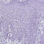 PRSS45 Antibody in Immunohistochemistry (Paraffin) (IHC (P))