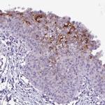 PRSS45 Polyclonal Antibody
