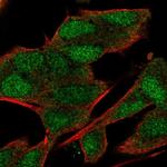 C20orf132 Polyclonal Antibody