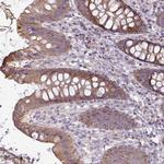 FAM40A Polyclonal Antibody