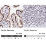 PLK3 Antibody