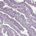 C8orf22 Antibody in Immunohistochemistry (Paraffin) (IHC (P))