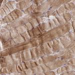 C8orf22 Antibody in Immunohistochemistry (Paraffin) (IHC (P))