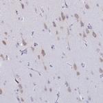 BRUNOL5 Polyclonal Antibody