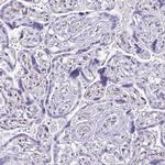 FAM162B Polyclonal Antibody