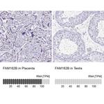 FAM162B Antibody in Immunohistochemistry (IHC)