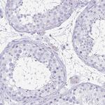 FAM162B Antibody in Immunohistochemistry (IHC)