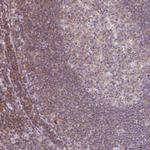 KIF26A Polyclonal Antibody
