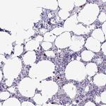 SATL1 Polyclonal Antibody