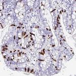 NANOGNB Antibody in Immunohistochemistry (Paraffin) (IHC (P))