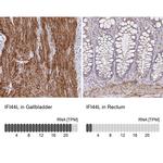 IFI44L Antibody in Immunohistochemistry (IHC)