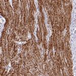 IFI44L Antibody in Immunohistochemistry (IHC)