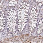 IFI44L Antibody in Immunohistochemistry (IHC)