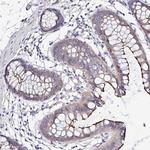 ARL4D Antibody in Immunohistochemistry (Paraffin) (IHC (P))