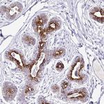 TAF1D Polyclonal Antibody