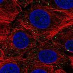 C7orf61 Polyclonal Antibody