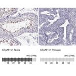 C7orf61 Antibody in Immunohistochemistry (IHC)