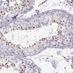 C7orf61 Antibody in Immunohistochemistry (IHC)