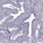 C7orf61 Antibody in Immunohistochemistry (IHC)