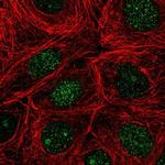 NUDT16 Polyclonal Antibody