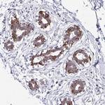 ANKRD30B Polyclonal Antibody