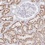 COL28A1 Antibody in Immunohistochemistry (Paraffin) (IHC (P))