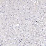 COL28A1 Antibody in Immunohistochemistry (Paraffin) (IHC (P))
