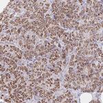COL28A1 Antibody in Immunohistochemistry (Paraffin) (IHC (P))