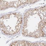 COL28A1 Polyclonal Antibody