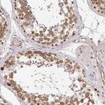 CLASRP Antibody in Immunohistochemistry (Paraffin) (IHC (P))