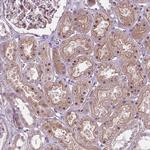 ARHE Antibody in Immunohistochemistry (Paraffin) (IHC (P))