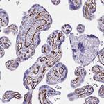 TRIM6 Polyclonal Antibody