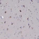 GPR148 Antibody in Immunohistochemistry (Paraffin) (IHC (P))