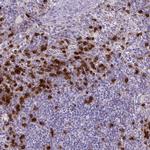 TMEM133 Antibody in Immunohistochemistry (Paraffin) (IHC (P))