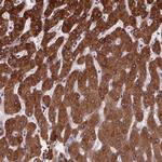 NDST1 Polyclonal Antibody