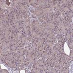 KIAA1161 Antibody in Immunohistochemistry (Paraffin) (IHC (P))