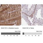 KIAA1161 Polyclonal Antibody
