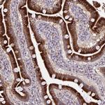 KIAA1161 Antibody in Immunohistochemistry (Paraffin) (IHC (P))