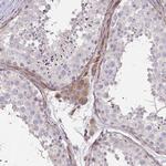 KIAA1161 Antibody in Immunohistochemistry (Paraffin) (IHC (P))