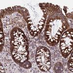 CP054 Antibody in Immunohistochemistry (Paraffin) (IHC (P))
